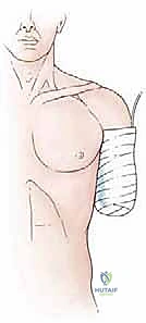 الأستاذ الدكتور محمد هطيف - أفضل دكتور عظام في اليمن