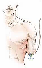 تقييم الأورام العظمية قبل الجراحة