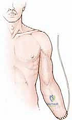 قصص نجاح في التغلب على أورام العظام