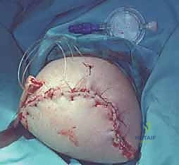 الريادة في جراحات العظام والأورام