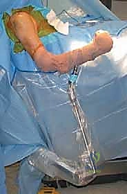 إعداد المريض للعملية الجراحية في الوضعية الصحيحة