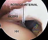 قراءة وتحليل صور الأشعة بدقة قبل اتخاذ القرار الجراحي