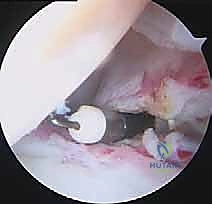 تجهيز غرفة العمليات بأحدث تقنيات مناظير 4K