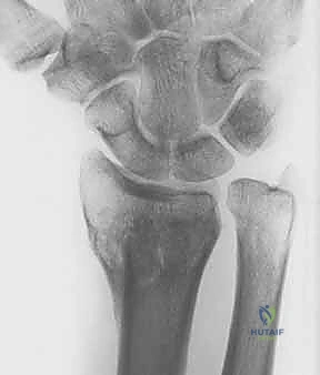 الأستاذ الدكتور محمد هطيف أثناء دراسة حالة معقدة