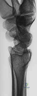 تجهيز المريض والتعقيم في غرفة العمليات