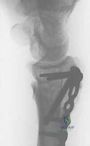 تحليل مقطعي لمفصل الرسغ