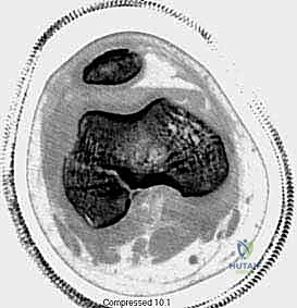 بيولوجيا العظم عند الأطفال