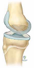 استخدام تقنيات التنظير الفلوري أثناء الجراحة