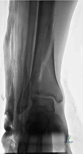 التخطيط قبل الجراحة