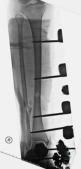 تغطية الجروح والعناية بها