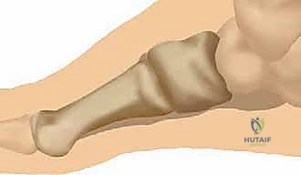 تقييم حالة المريض قبل الجراحة