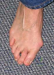 الأعصاب والشرايين في القدم