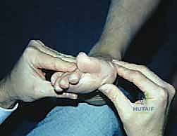 العضلات المحيطة بإبهام القدم