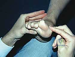 مفصل رسغ القدم الأول