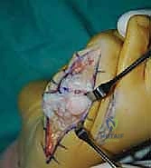 الفحص السريري للقدم