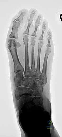 صورة توضح الفرق في الأنسجة