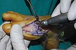 استخدام التقنيات الحديثة في التشخيص