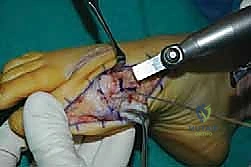 فحص دقيق لمفصل القدم