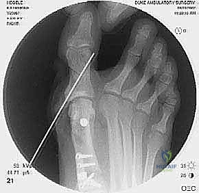 صورة نهائية بعد الإغلاق