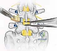 تقييم الحالة العصبية للمريض
