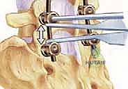 استخدام التقنيات الميكروسكوبية الدقيقة