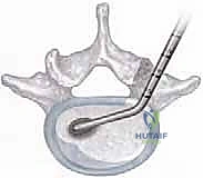 الأستاذ الدكتور محمد هطيف أثناء التخطيط الجراحي