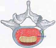 تحديد الفقرات بالأشعة أثناء الجراحة