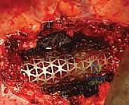 تشريح العمود الفقري الصدري وأهميته