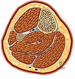 الشق الجراحي الصغير