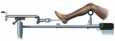 أحدث تقنيات جراحة العظام في صنعاء