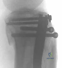 التخدير والتعقيم في غرفة العمليات