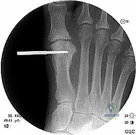 تجهيز المريض والتخدير في غرفة العمليات