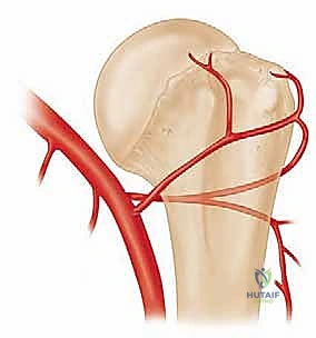 مقارنة بين الخيارات العلاجية