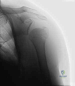 تجهيز المريض في غرفة العمليات