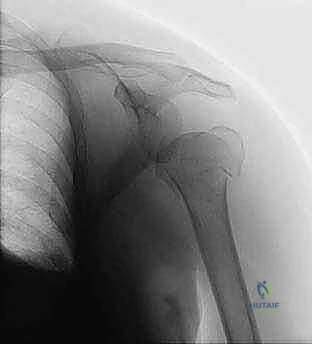 الحفاظ على التروية الدموية