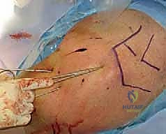 التثبيت النهائي للأسلاك