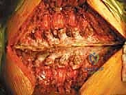 الأستاذ الدكتور محمد هطيف أثناء الجراحة