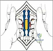 إمرار منشار السلك لقطع العنيقات