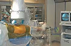 انحشار الورك من نوع كام Cam