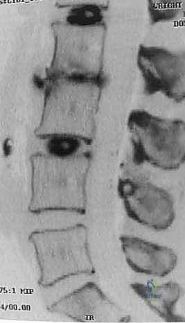 مناقشة الخيارات العلاجية مع المريض