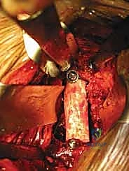 الأستاذ الدكتور محمد هطيف أثناء إجراء جراحة دقيقة