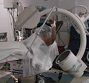 التشريح الدقيق لمفصل الكتف وعظم العضد