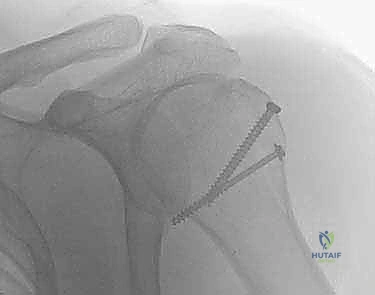 استخدام الأشعة المقطعية ثلاثية الأبعاد في التخطيط الجراحي