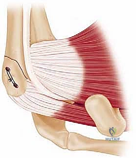 التقنيات الجراحية الحديثة في عمليات الكتف