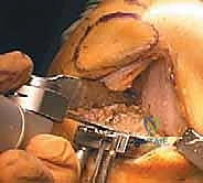 التشخيص الدقيق باستخدام الأشعة السينية بوضع الوقوف