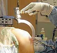 التشريح الدقيق لمفصل الركبة وتوزيع الأحمال