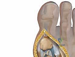 أسباب تيبس إبهام القدم