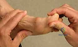 العلاجات التحفظية لتيبس القدم