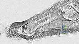 تشريح مفصل إبهام القدم الكبير