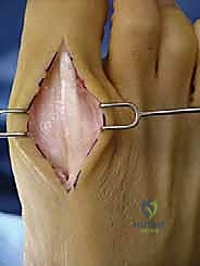 الأستاذ الدكتور محمد هطيف أثناء الفحص